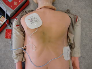 写真：人体模型に電極パッドを貼る